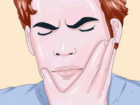 Перелом челюсти